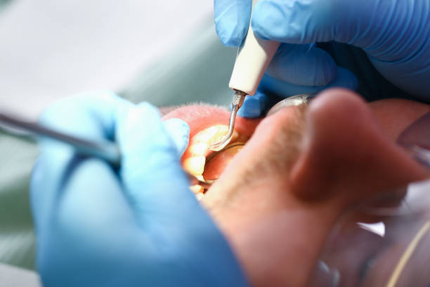 Best Emergency Orthodontic Repairs in Pine Mountain Clu, CA