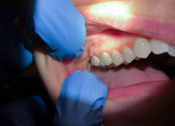 Best Pediatric Emergency Dentist in Pine Mountain Clu, CA